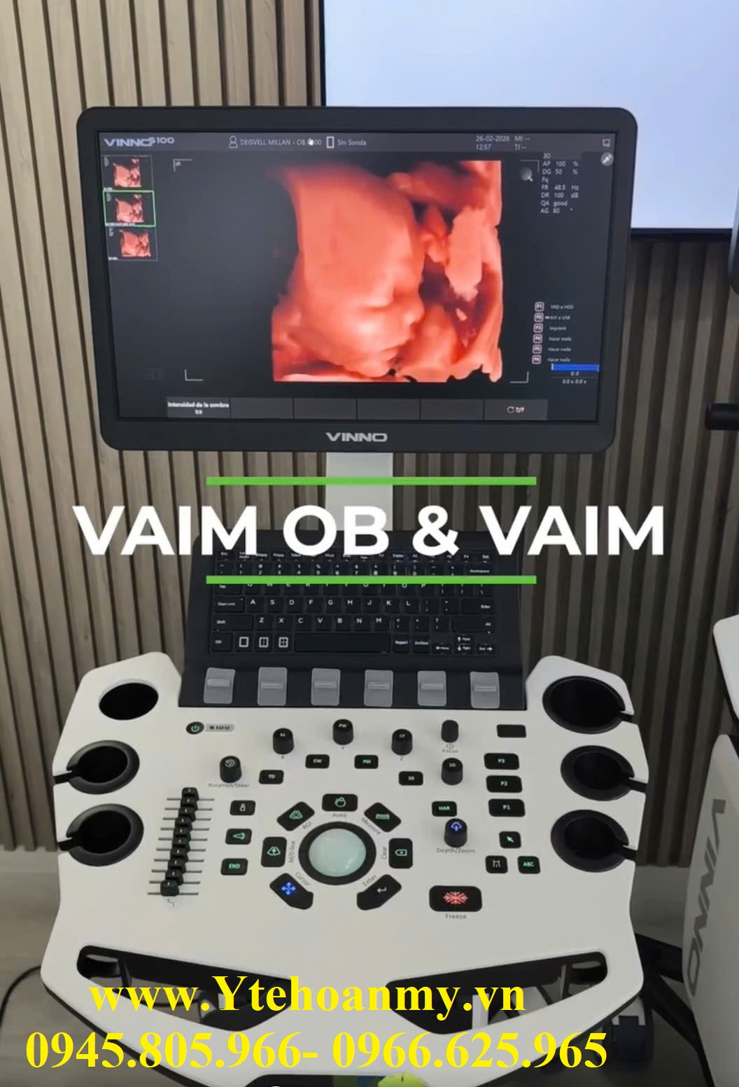 Máy siêu âm 5D Vinno S100